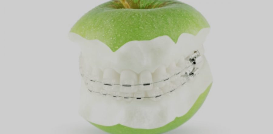 Orthodontics